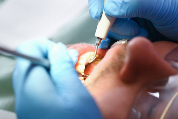 Best Emergency Treatment for Toothache in Centerville, UT